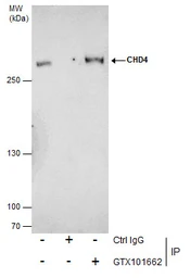 Anti-CHD4 antibody used in Immunoprecipitation (IP). GTX101662