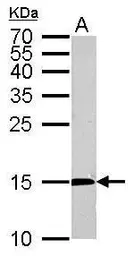 Anti-CDA antibody used in Western Blot (WB). GTX101673