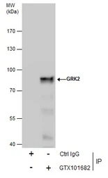 Anti-GRK2 antibody [C2C3], C-term used in Immunoprecipitation (IP). GTX101682