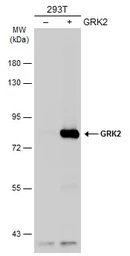 Anti-GRK2 antibody [C2C3], C-term used in Western Blot (WB). GTX101682
