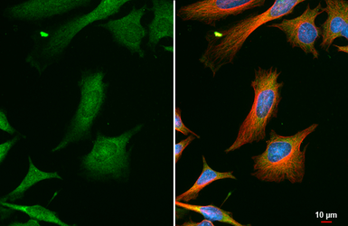 Anti-GRK2 antibody [C2C3], C-term used in Immunocytochemistry/ Immunofluorescence (ICC/IF). GTX101682