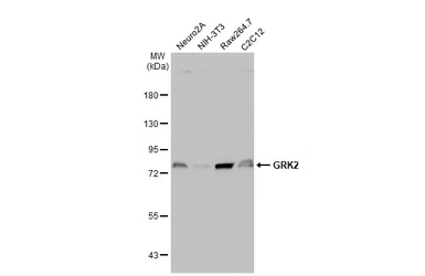 Anti-GRK2 antibody [C2C3], C-term used in Western Blot (WB). GTX101682