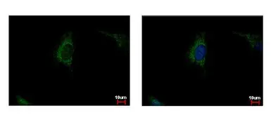 Anti-SDHA antibody used in Immunocytochemistry/ Immunofluorescence (ICC/IF). GTX101689