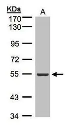 Anti-ILK antibody [N1C1] used in Western Blot (WB). GTX101691