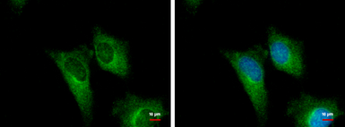 Anti-PGD antibody [N1N3] used in Immunocytochemistry/ Immunofluorescence (ICC/IF). GTX101703