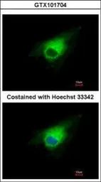 Anti-PGD antibody used in Immunocytochemistry/ Immunofluorescence (ICC/IF). GTX101704
