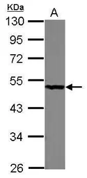 Anti-PGD antibody used in Western Blot (WB). GTX101704