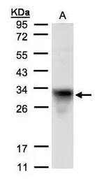 Anti-CYC1 antibody used in Western Blot (WB). GTX101717