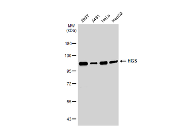 Anti-HGS antibody [C2C3], C-term used in Western Blot (WB). GTX101718