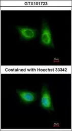 Anti-SOS2 antibody used in Immunocytochemistry/ Immunofluorescence (ICC/IF). GTX101723