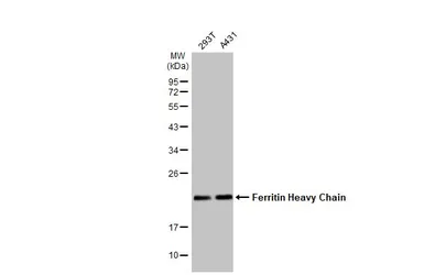 Anti-Ferritin Heavy Chain antibody [N1C3] used in Western Blot (WB). GTX101733