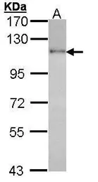 Anti-HGS antibody used in Western Blot (WB). GTX101738