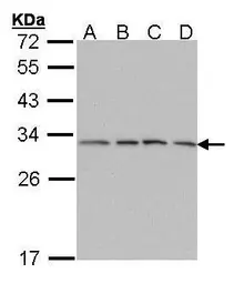 Anti-PSMA7 antibody [N1C3] used in Western Blot (WB). GTX101745