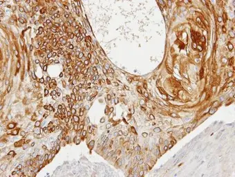 Anti-Creatine kinase (brain) antibody [N3C3] used in IHC (Paraffin sections) (IHC-P). GTX101760