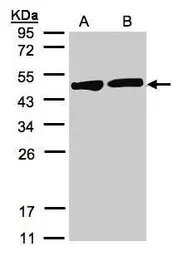 Anti-Creatine kinase (brain) antibody [N3C3] used in Western Blot (WB). GTX101760