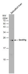 Anti-Sec61 gamma subunit antibody used in Western Blot (WB). GTX101782