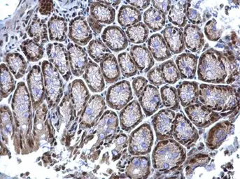 Anti-hnRNP K antibody used in IHC (Paraffin sections) (IHC-P). GTX101786
