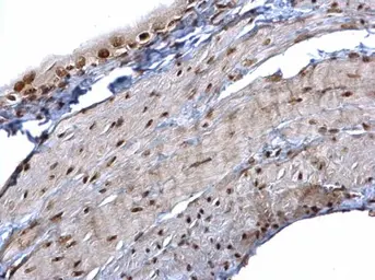 Anti-hnRNP K antibody used in IHC (Paraffin sections) (IHC-P). GTX101786