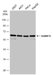 Anti-hnRNP K antibody used in Western Blot (WB). GTX101786