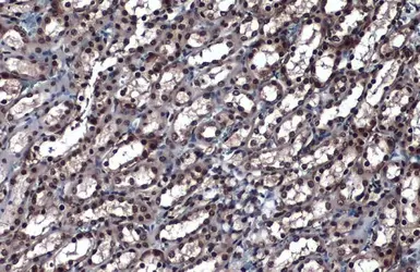 Anti-hnRNP K antibody used in IHC (Paraffin sections) (IHC-P). GTX101786