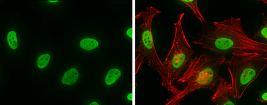 Anti-hnRNP K antibody used in Immunocytochemistry/ Immunofluorescence (ICC/IF). GTX101786