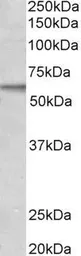 Anti-ACVRL1 antibody, C-term used in Western Blot (WB). GTX10179