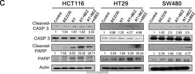 Anti-Actin Gamma 1 antibody used in Western Blot (WB). GTX101794