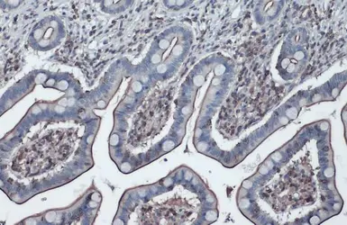 Anti-Actin Gamma 1 antibody used in IHC (Paraffin sections) (IHC-P). GTX101794