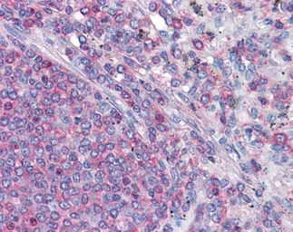 Anti-Actin Gamma 1 antibody used in IHC (Paraffin sections) (IHC-P). GTX101794