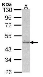 Anti-Actin Gamma 1 antibody used in Western Blot (WB). GTX101794