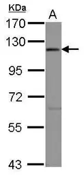 Anti-EIF3S8 antibody [C2C3], C-term used in Western Blot (WB). GTX101801