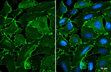 Anti-EPB41L3 antibody [C3], C-term used in Immunocytochemistry/ Immunofluorescence (ICC/IF). GTX101805