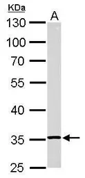 Anti-RPL5 antibody used in Western Blot (WB). GTX101821