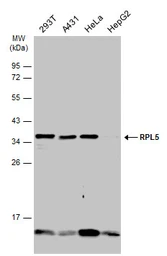 Anti-RPL5 antibody used in Western Blot (WB). GTX101821