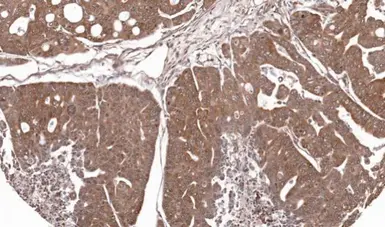 Anti-RPL5 antibody used in IHC (Paraffin sections) (IHC-P). GTX101821