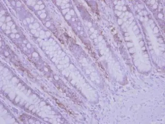 Anti-RPLP2 antibody used in IHC (Paraffin sections) (IHC-P). GTX101823