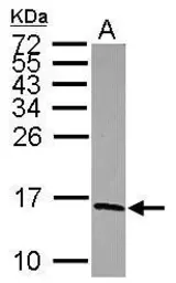 Anti-NDUFS5 antibody used in Western Blot (WB). GTX101829