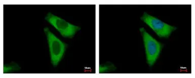 Anti-RPL29 antibody used in Immunocytochemistry/ Immunofluorescence (ICC/IF). GTX101833
