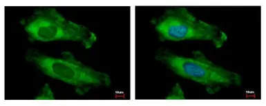 Anti-RPS10 antibody used in Immunocytochemistry/ Immunofluorescence (ICC/IF). GTX101836