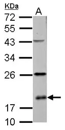 Anti-RPS10 antibody used in Western Blot (WB). GTX101836