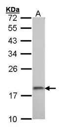 Anti-RPS10 antibody used in Western Blot (WB). GTX101836
