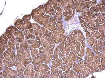 Anti-RPS15 antibody used in IHC (Paraffin sections) (IHC-P). GTX101839