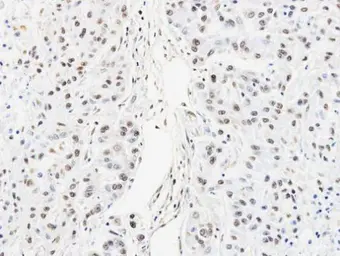 Anti-hnRNP AB antibody used in IHC (Paraffin sections) (IHC-P). GTX101852