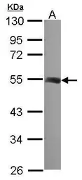 Anti-beta Tubulin 2 antibody [N1C1] used in Western Blot (WB). GTX101863
