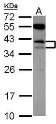 Anti-CD79b antibody used in Western Blot (WB). GTX101873