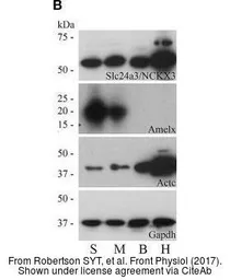 Anti-alpha Cardiac Muscle Actin antibody used in Western Blot (WB). GTX101876