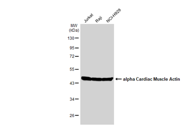 Anti-alpha Cardiac Muscle Actin antibody used in Western Blot (WB). GTX101876