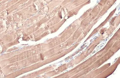 Anti-alpha Cardiac Muscle Actin antibody used in IHC (Paraffin sections) (IHC-P). GTX101876