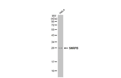 Anti-SNRPB antibody used in Western Blot (WB). GTX101883