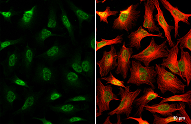 Anti-SNRPB antibody used in Immunocytochemistry/ Immunofluorescence (ICC/IF). GTX101883
